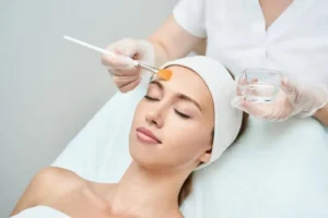 Chemical Peel by Signature Aesthetics & IV Lounge in Liberty Hill, Tx