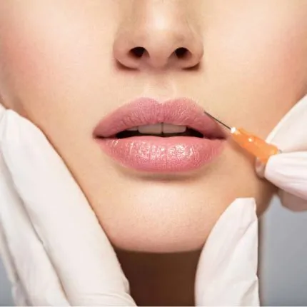 Dermal Fillers Treatment | Signature Aesthetics & IV Lounge | Liberty Hill, Tx